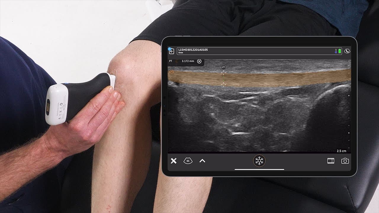 MSK diagnostic ultrasound being used during a physical therapy session